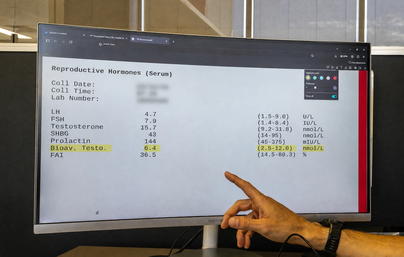 Clinical notes and health results being reviewed
